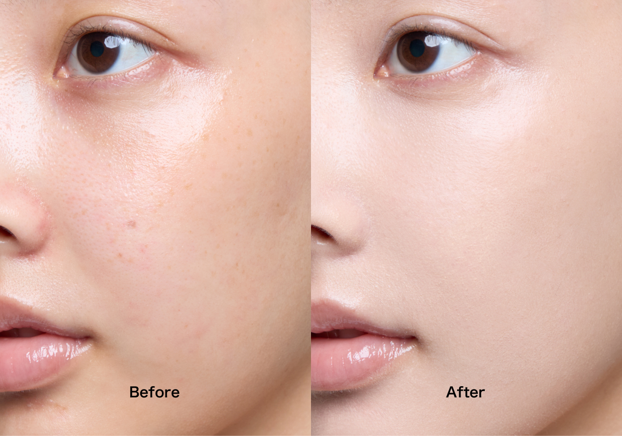 ビフォーアフター